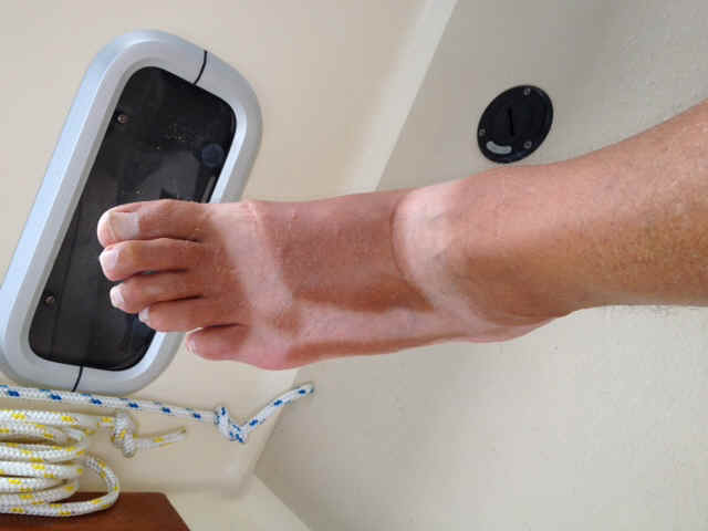 foot.JPG (91785 bytes)