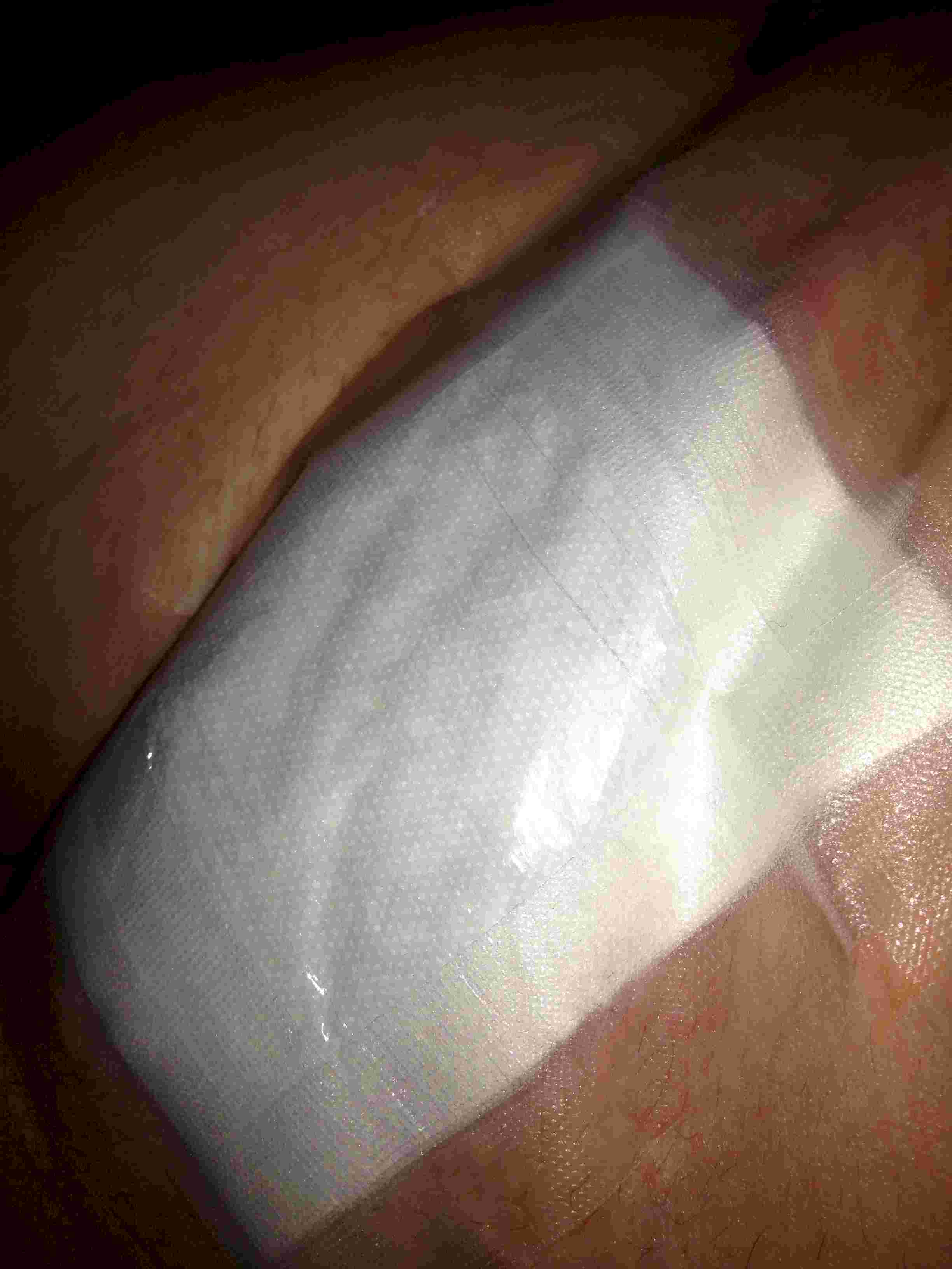 FL surgery.jpg (159187 bytes)